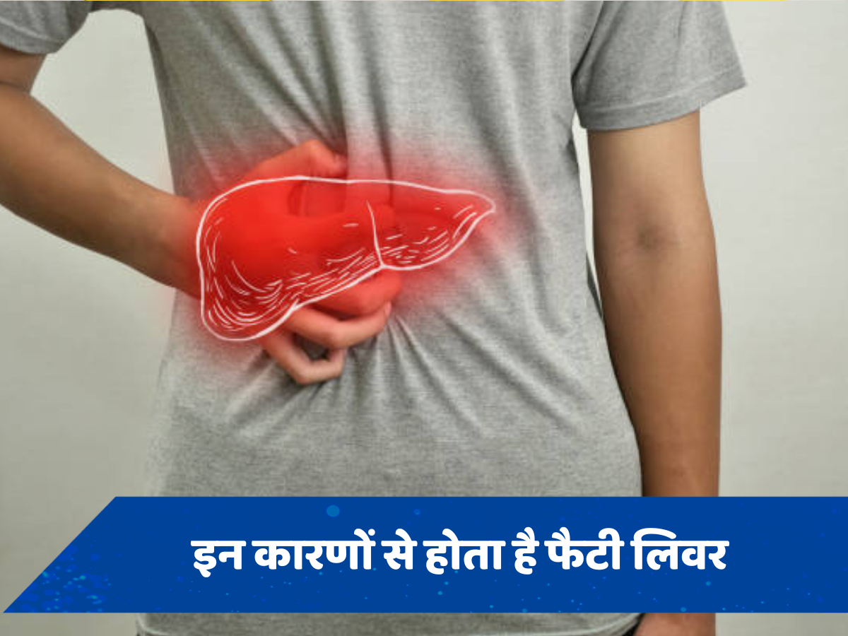 इन गंदी आदतों के कारण लिवर में जमता है फैट, कभी भी बन सकते हैं Fatty Liver का शिकार