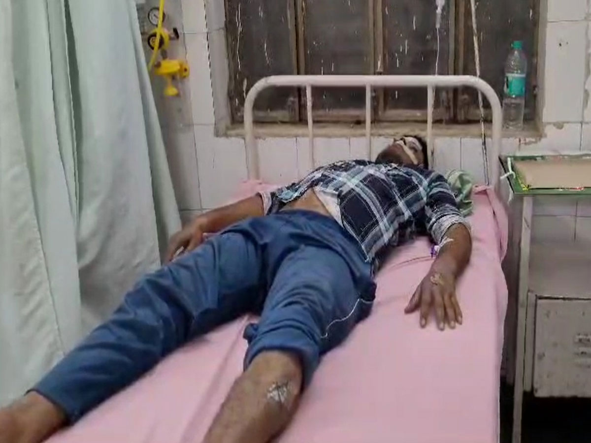 मृत समझकर डॉक्टर कर रहे थे इलाज, अचानक उठ बैठा शख्स, फटी रह गई सबकी आंखें