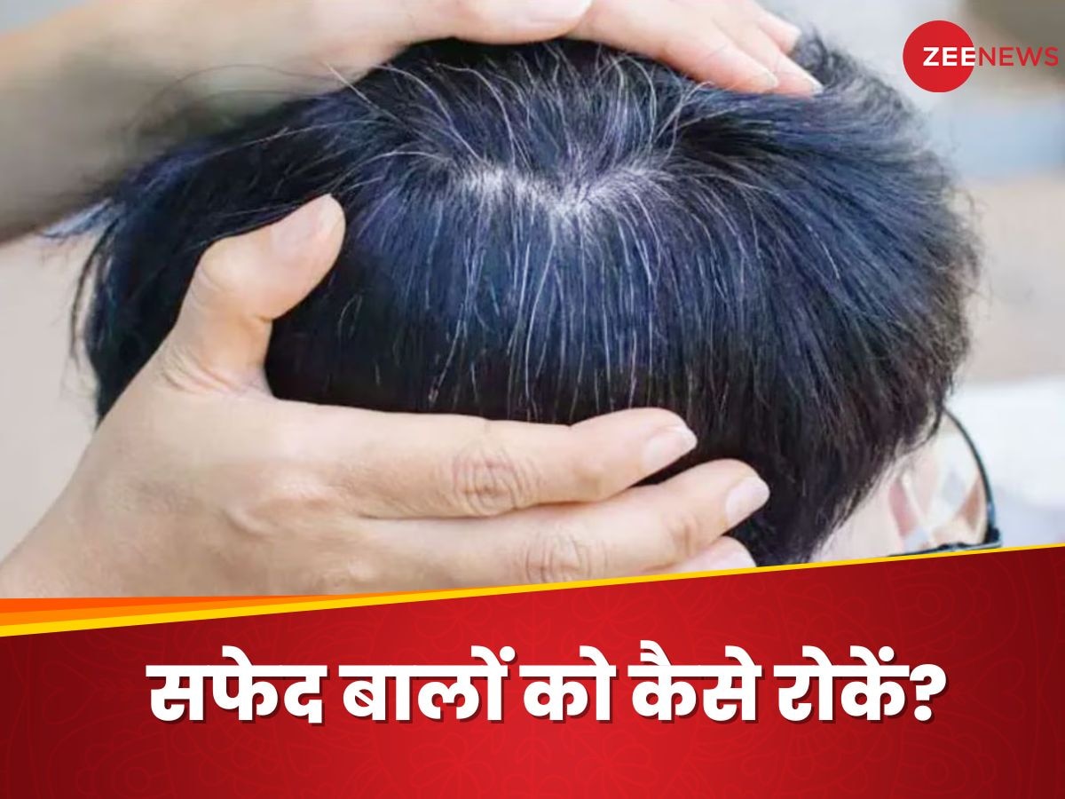 White Hair: यंग एज में सिर पर न आने दें सफेद बाल, इन्हें रोकने के लिए ये आसान उपाय आएंगे काम