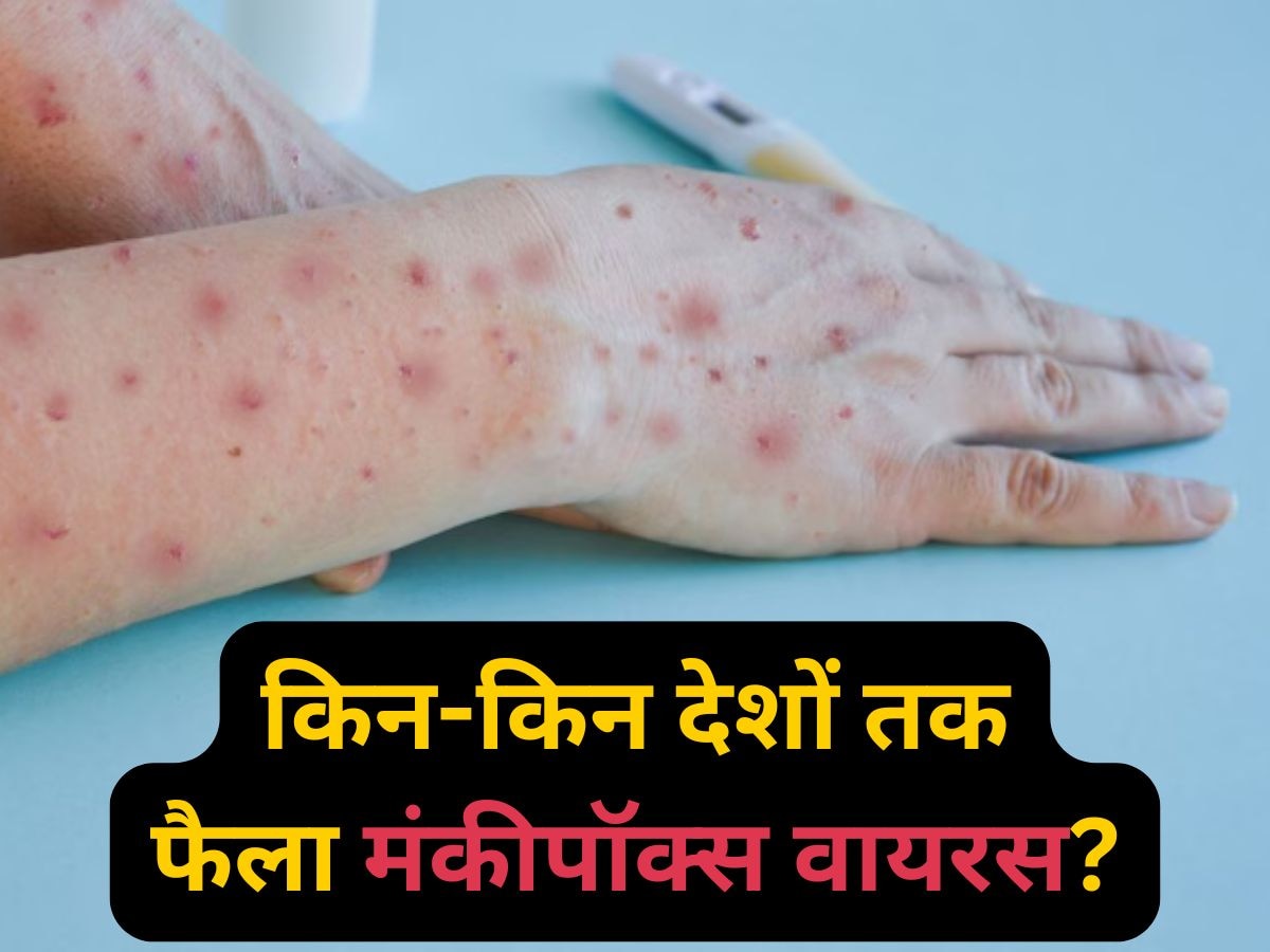 Mpox Outbreak: मंकीपॉक्स का बढ़ता प्रकोप, किन-किन देशों तक वायरस ने पसारा पैर? जानें खुद को कैसे रखें सुरक्षित