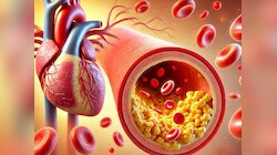Bad Cholesterol: नसों में जमी गंदगी को निचोड़कर बाहर फेंक देता है इस बीज का पानी!