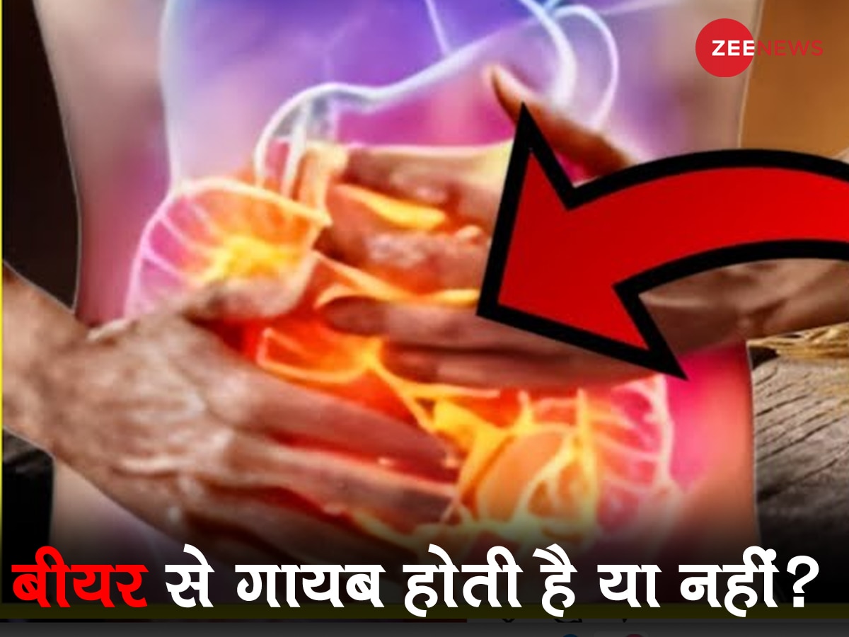 Knowledge News: क्या बीयर वाकई किडनी स्टोन को कर सकती है गायब? एक्सपर्ट ने सामने लाया सच