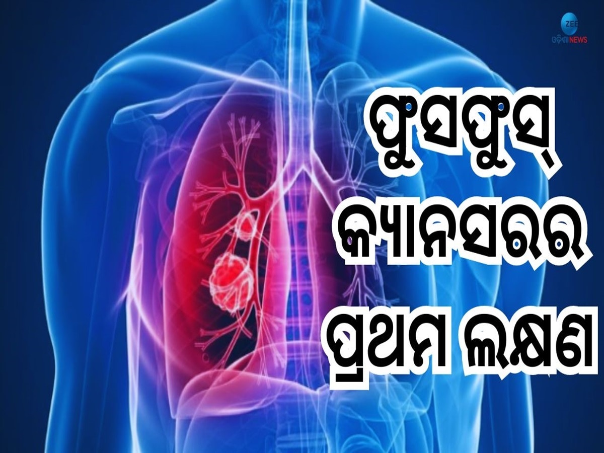 Lungs Cancer: ଫୁସଫୁସ୍ କର୍କଟର ନୂଆ ଲକ୍ଷଣ, ହାଡ଼ରୁ ନେଇ ଛାତି ଯାଏ ଦେଖାଦେଉଛି ଏସବୁ ଲକ୍ଷଣ