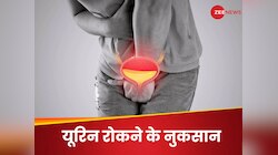 यूरिन देर तक रोककर रखते हैं आप? तुरंत बदलें आदत, नहीं तो हो सकते हैं ऐसे नुकसान