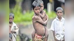 Baran News: फेल साबित हो रहीं सरकार की कल्याणकारी योजनाएं! लगातार बढ़ रहा कुपोषण