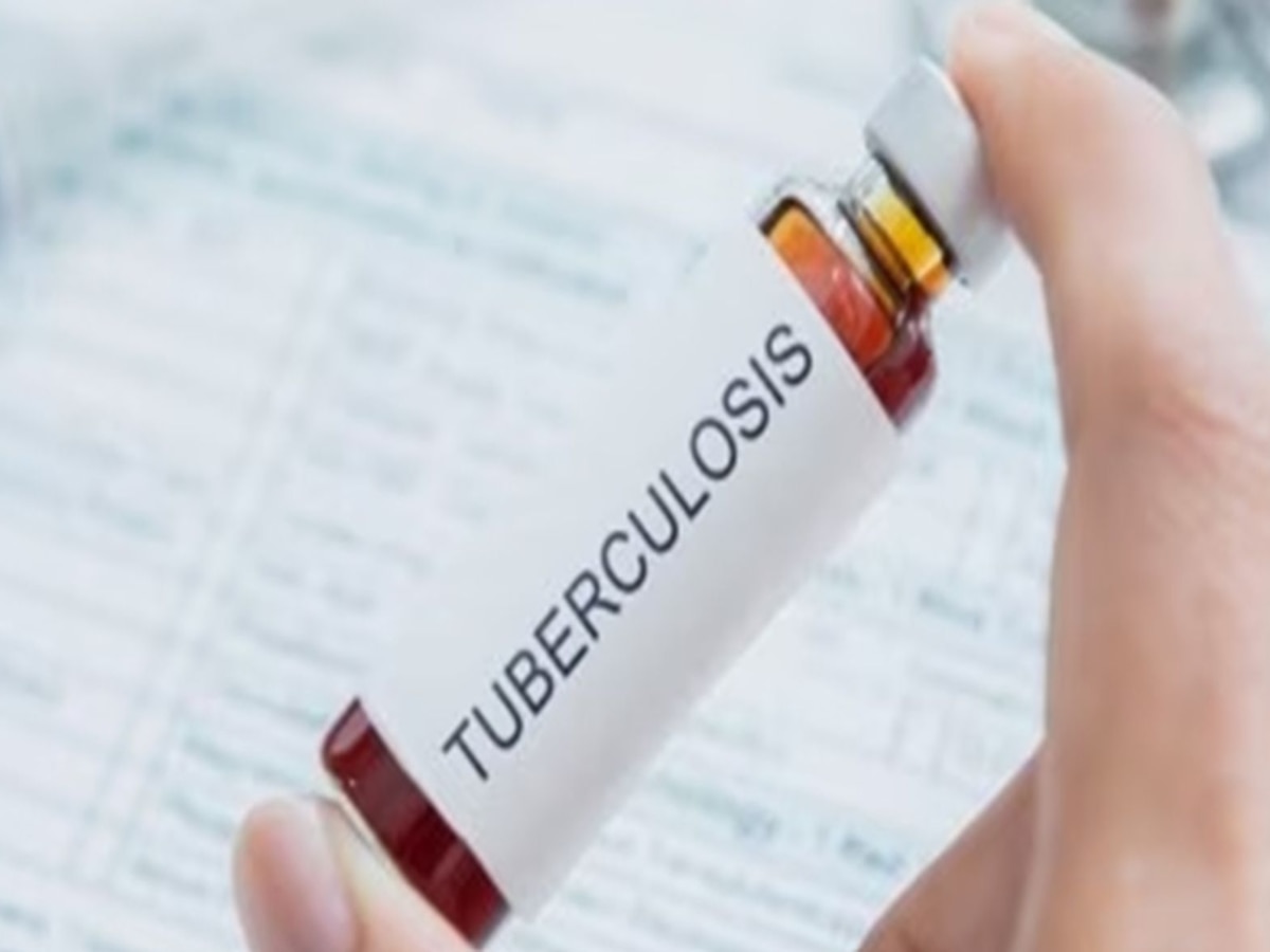 Multi-drug-resistant TB