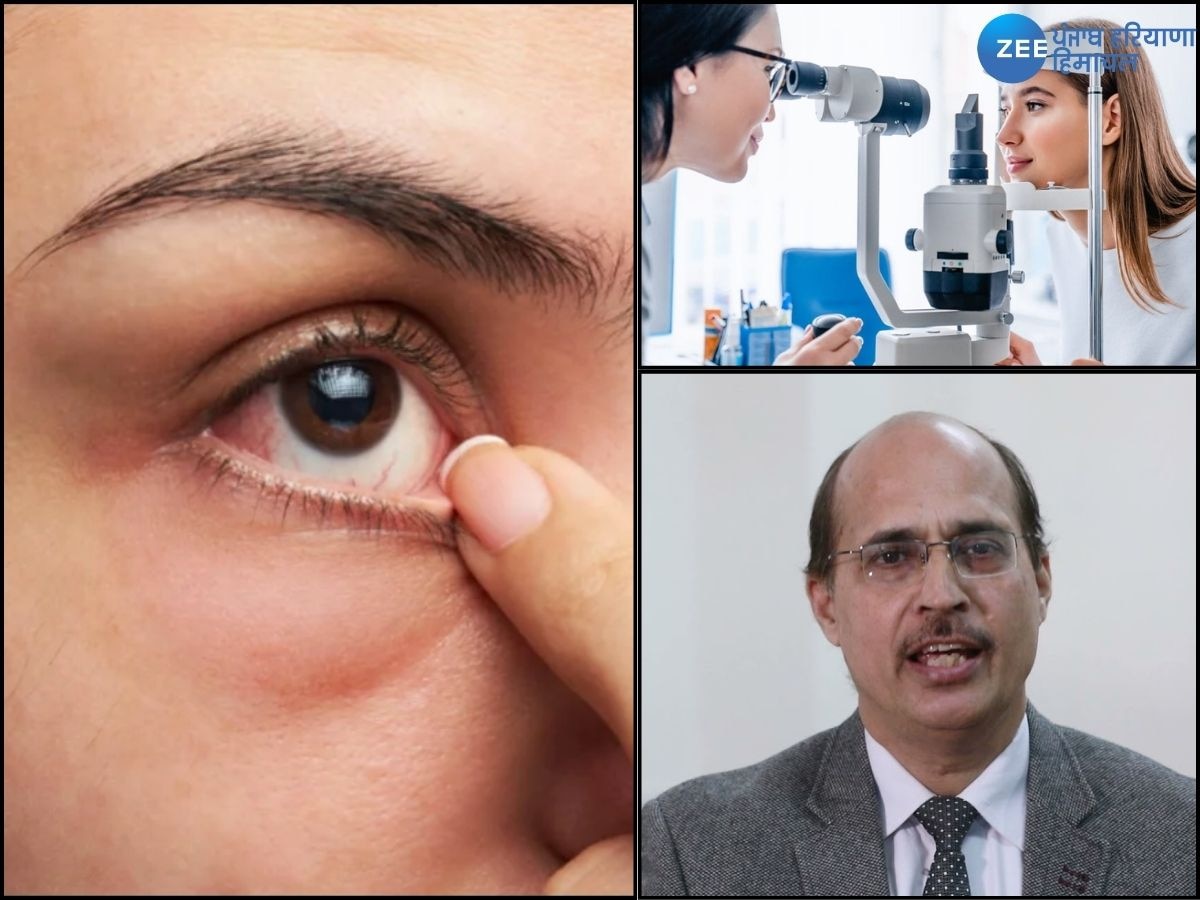 Diabetic Retinopathy: ਸ਼ੂਗਰ ਲੈਵਲ ਵਧਣ ਕਾਰਨ ਜਾ ਸਕਦੀ ਹੈ ਅੱਖਾਂ ਦੀ ਰੌਸ਼ਨੀ, ਜਾਣੋ ਕੀ ਹੁੰਦੀ ਹੈ ਡਾਇਬੀਟਿਕ ਰੈਟੀਨੋਪੈਥੀ 