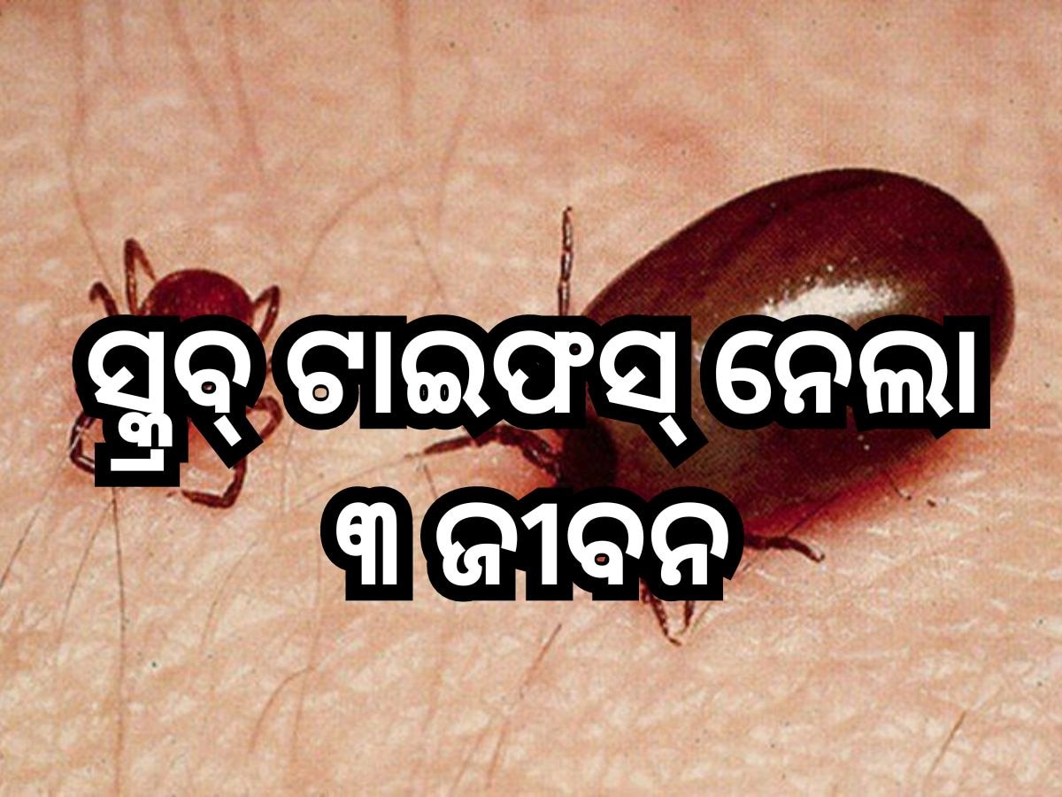 Odisha News: ବରଗଡରେ ଆତଙ୍କ ଖେଳାଇଛି ସ୍କ୍ରବ୍‌ ଟାଇଫସ୍‌, ୩ ମୃତ