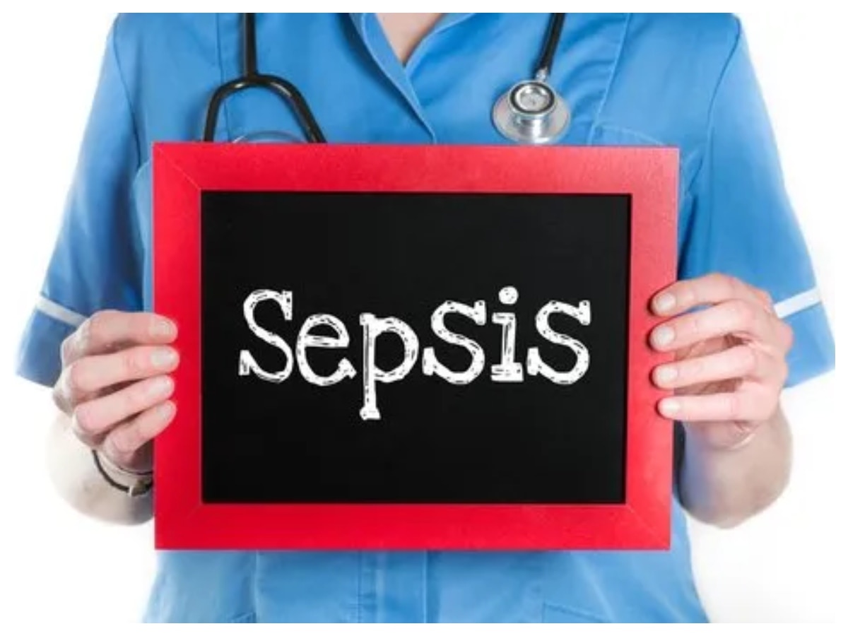 Sepsis Day 2024: सेप्सिस का अर्ली डिटेक्शन, बचाएगा अस्पताल का खर्च, जानिए क्या हैं इस बीमारी के लक्षण