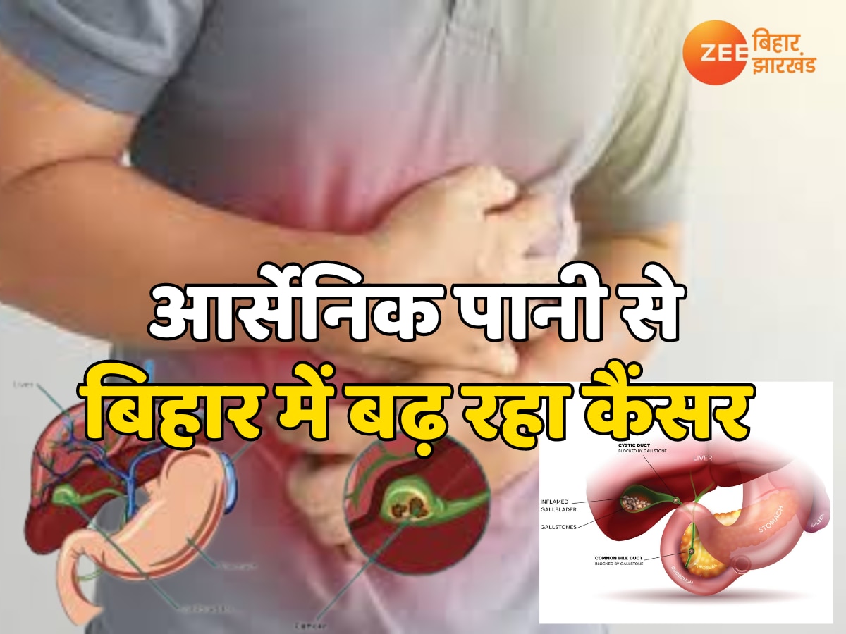 Gall Bladder Cancer: बिहार में गंगा के आर्सेनिक पानी से बढ़ रहा कैंसर, इन 20 जिलों से सामने आए नए मामले