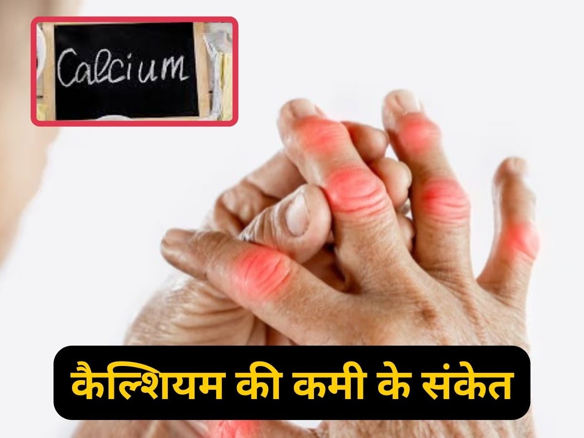 Calcium Deficiency: कैल्शियम की कमी होने पर शरीर इस तरह देता है इशारा, नजरअंदाज करना पड़ेगा भारी