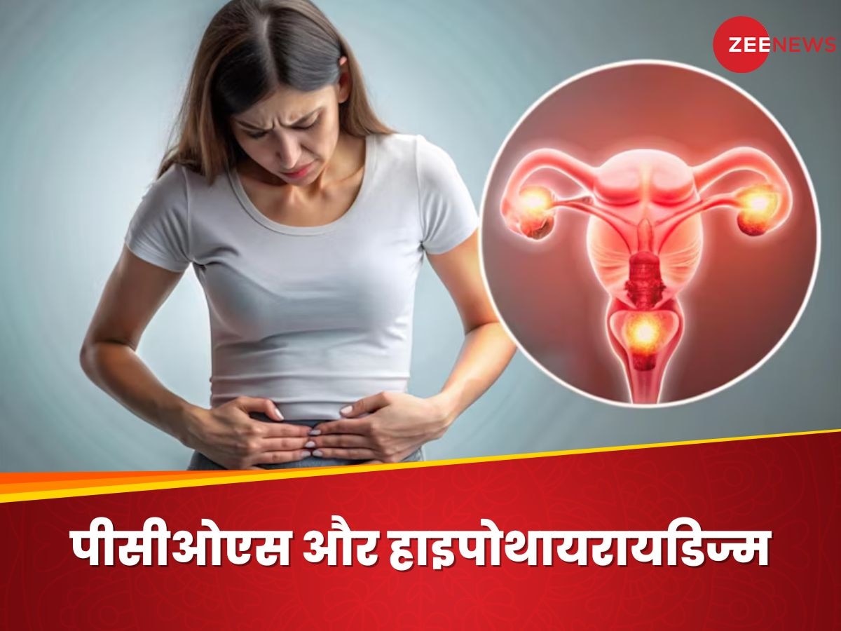 PCOS और Hypothyroidism का रिश्ता महिलाओं के लिए परेशानी का सबब,  जानिए कैसे होगा डायग्नोसिस