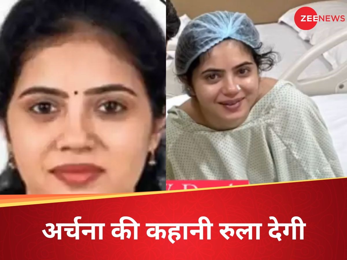 Archana Kamath: मौसी को लिवर डोनेट किया था फिर क्या हुआ? 33 साल की अर्चना की मौत पर रो पड़े लोग