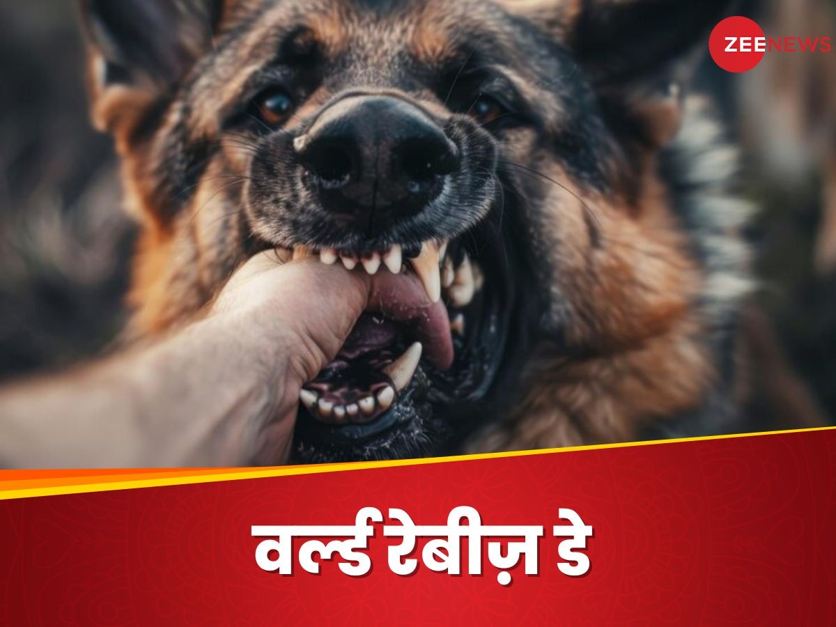 Rabies: कुत्ते के काटने से क्यों फैलता है रेबीज? जानिए खतरनाक वायरस से कैसे बच सकते हैं आप