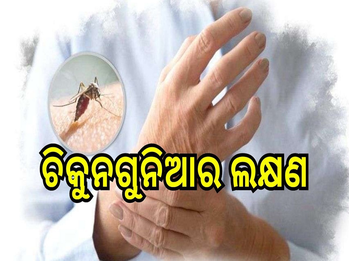 Chikungunya: ମ୍ୟାଲେରିଆ ଓ ଡେଙ୍ଗୁ ଠାରୁ ମାରାତ୍ମକ ଚିକୁନଗୁନିଆ! ଜ୍ୱର ହେବା ସହ ଦେଖା ଦେଇଥାଏ ଏହି ସବୁ ଲକ୍ଷଣ!