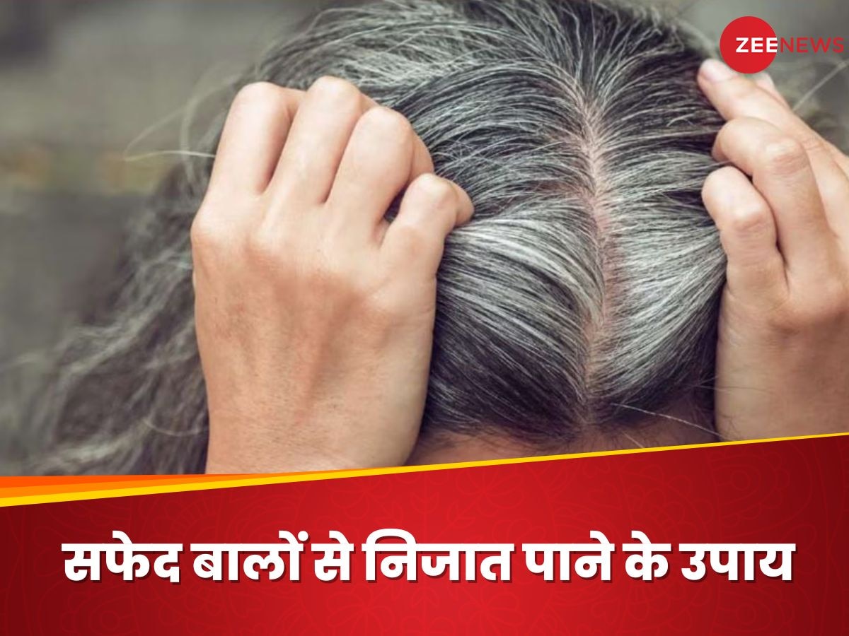 Cobalamin की कमी से बाल होते हैं सफेद, करेंगे ऐसे उपाय तो वापस नहीं आएंगे White Hair