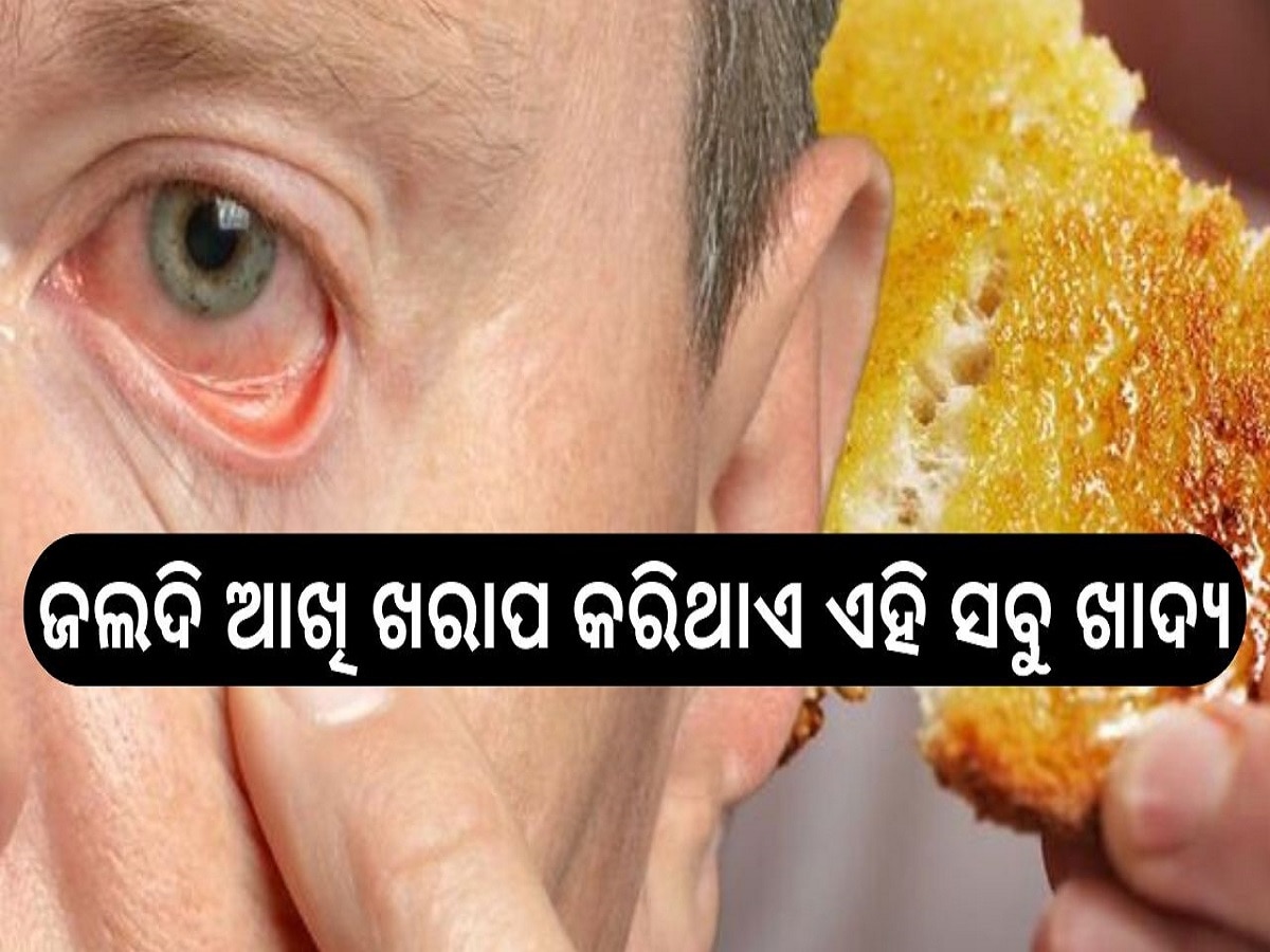 Worst Foods for Eyes: ବୟସ ପୂର୍ବରୁ ଆଖି ଖରାପ କରିଥାଏ ଏହି ସବୁ ଖାଦ୍ୟ....