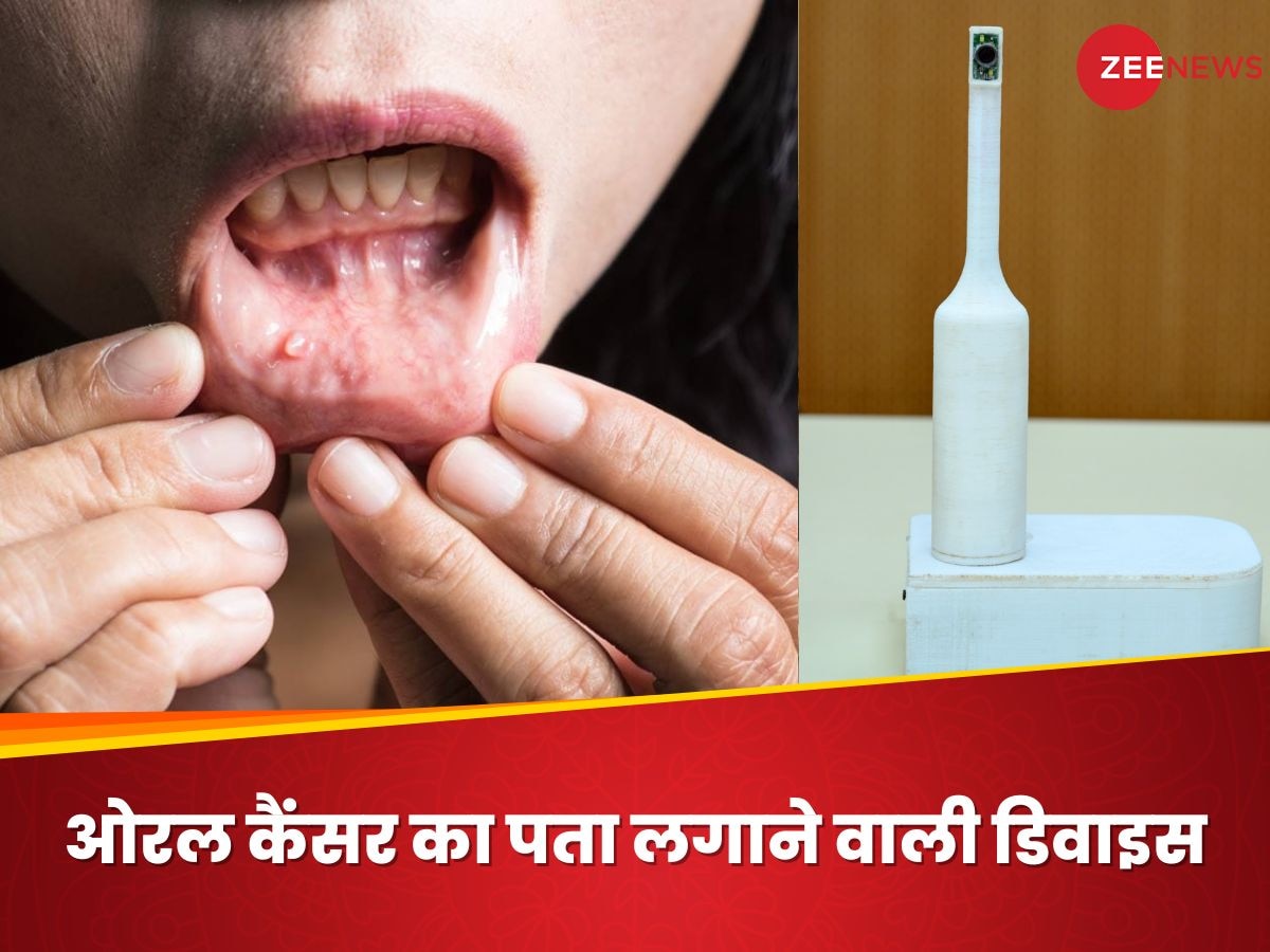 Mouth Cancer का पता लगाएगा टूथब्रश,  जल्द बाजार में आएगी IIT Kanpur में बनी ये डिवाइस 