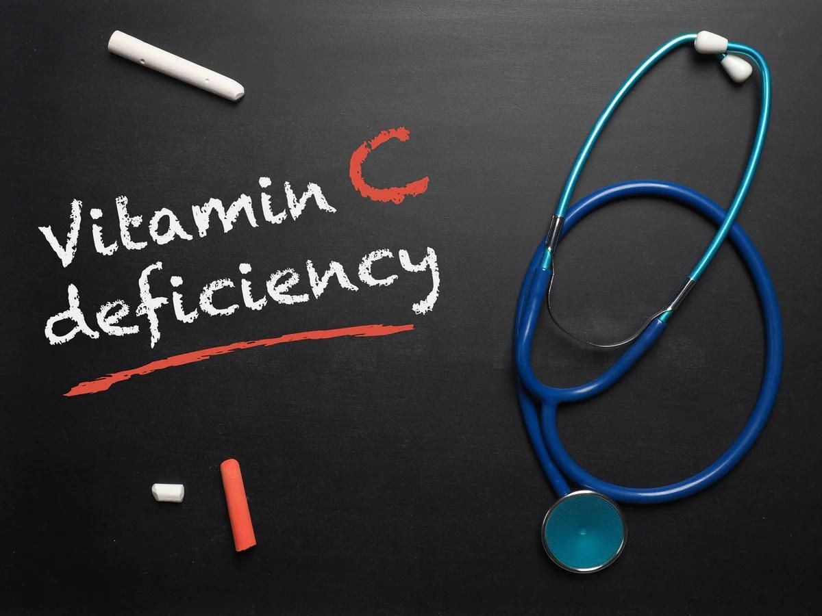 Vitamin C Deficiency: विटामिन सी की कमी हो जाने पर हो जाती हैं ये दो गंभीर समस्याएं