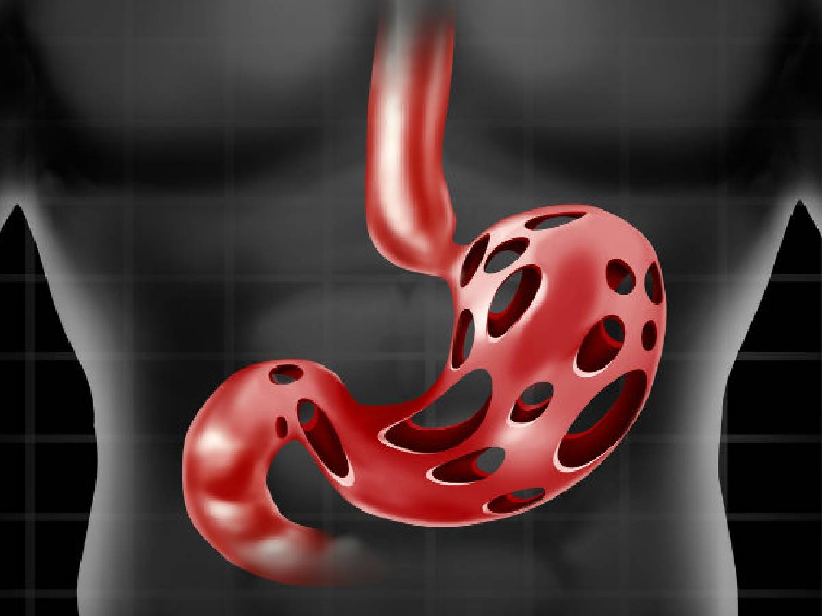 इस जंगली सब्जी में छिपा है कई बीमारियों का इलाज, पेट में जाते ही बन जाती है संजीवनी बूटी