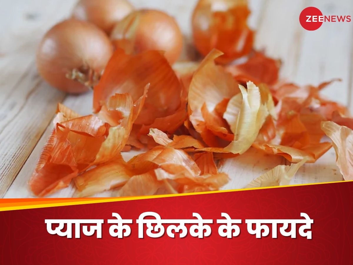 Onion Peels: बेकार समझकर कचरे में न फेंकें प्याज के छिलके, इस तरह यूज करेंगे तो होंगे फायदे