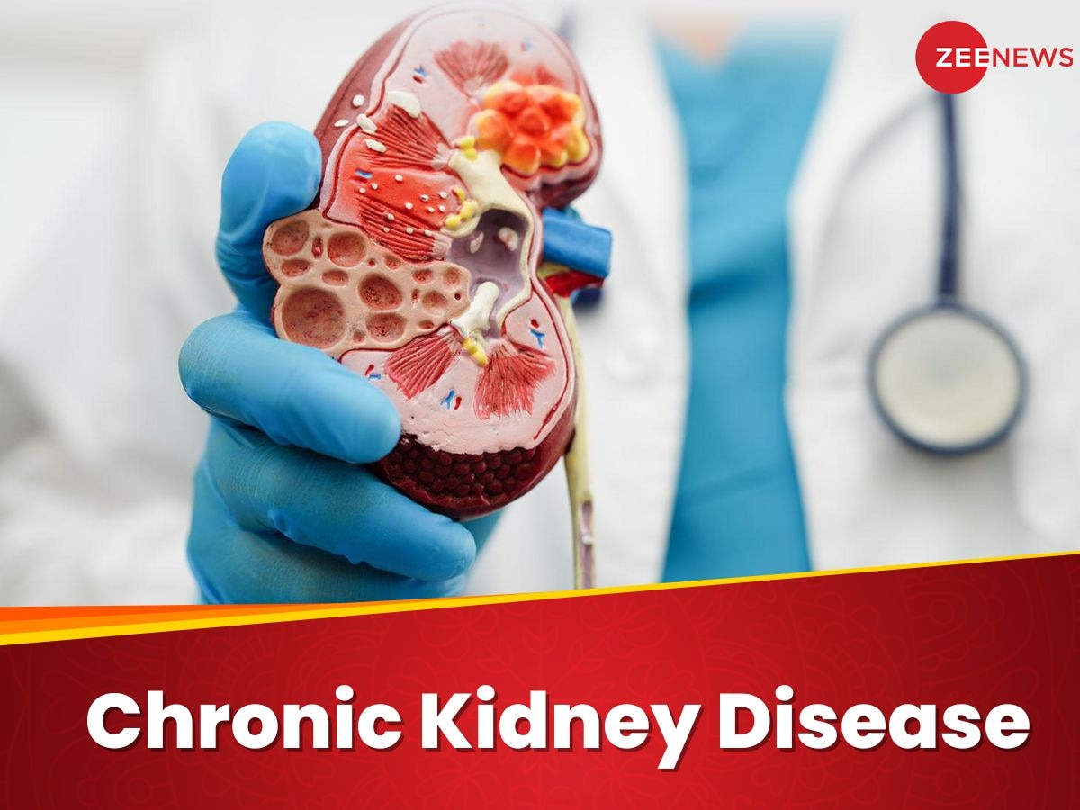 किडनी की वो बीमारी, जो देती है धीमी मौत, जान लें क्या है CKD और कैसे करें इससे बचाव