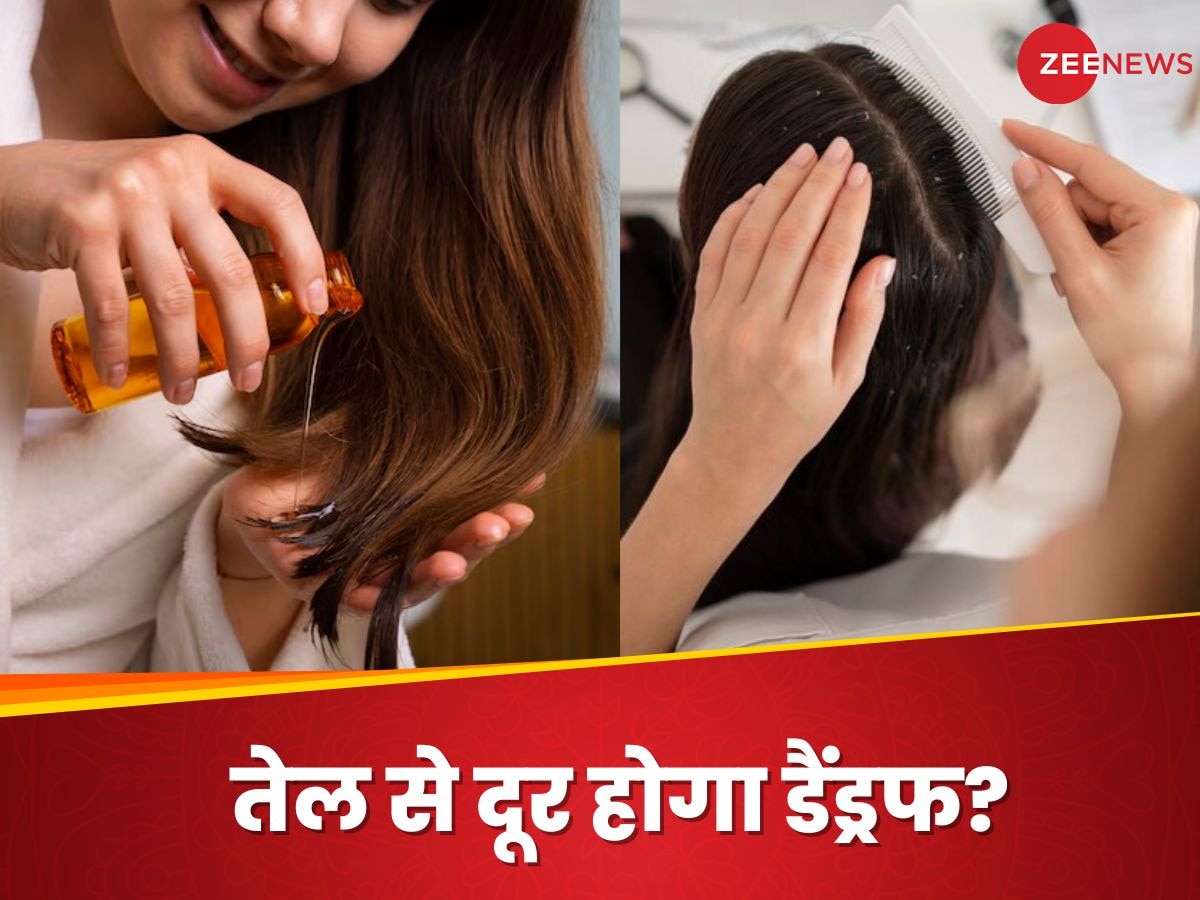 Dandruff: क्या तेल लगाने से दूर हो सकती है डैंड्रफ की प्रॉब्लम? या फिर यही है परेशानी की असली जड़?