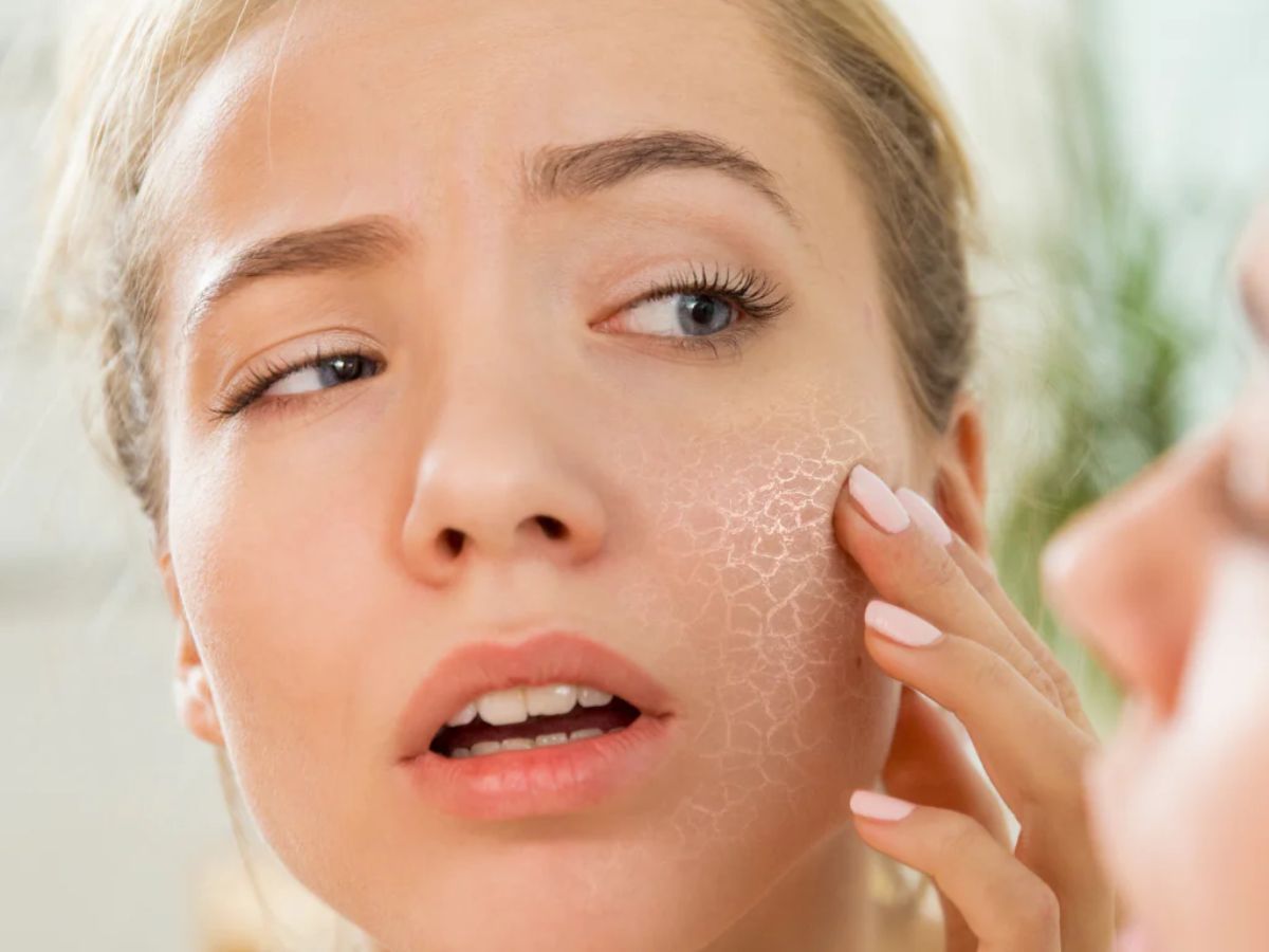 ड्राई स्किन