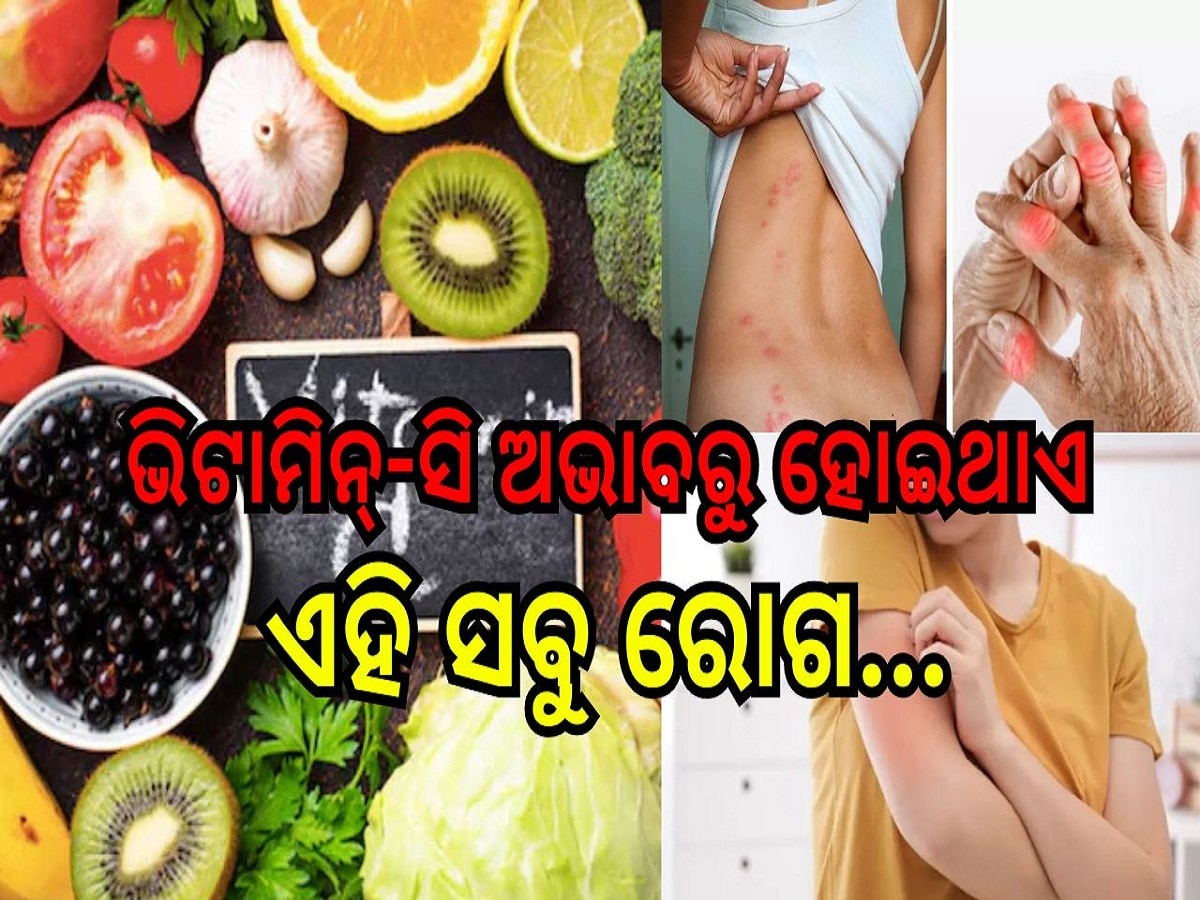 Vitamin-C Deficiency: ଭିଟାମିନ୍-ସି ଅଭାବରୁ ଶରୀରରେ ଦେଖାଯାଇଥାଏ ଏହି ସବୁ ସମସ୍ୟା..