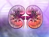 kidney
