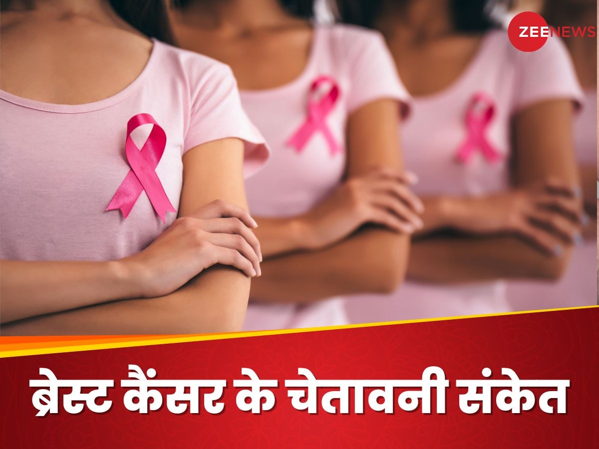 Breast Cancer Symptoms: स्तन में गांठ होना ही नहीं ब्रेस्ट कैंसर के लक्षण, इन तरह भी मिलते हैं चेतावनी संकेत