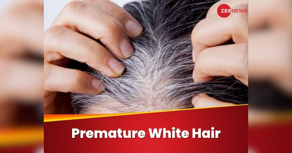 Premature White Hair With 5 Easy Ways Safed baal Kaise Roken | White ...