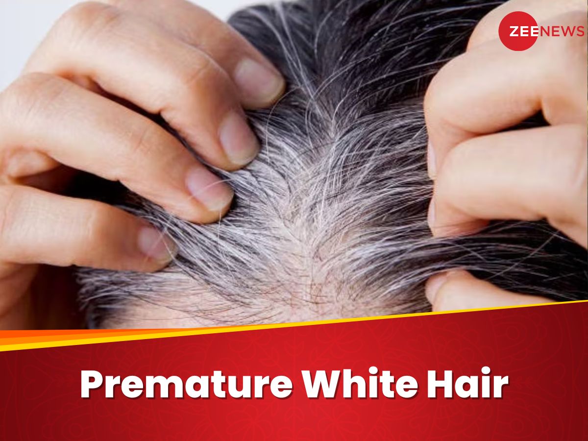 Lush Premature White Hair Landscape in 4K Lush Premature White Hair Landscape in 4K