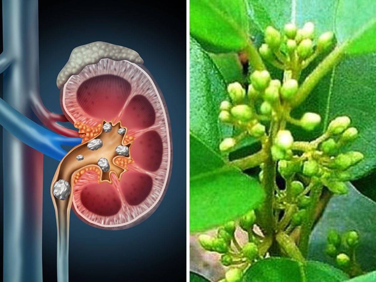 Kidney Blockage: किडनी की ब्लॉकेज को खोलने के लिए आयुर्वेद के 3 चमत्कारी नुस्खे, यूरिया का खतरा होगा खत्म!