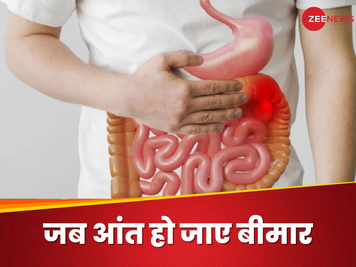 Unhealthy Gut: आंतों में खराबी आने पर शरीर में दिखते हैं ऐसे लक्षण, इग्नोर करने से बढ़ेगी परेशानी