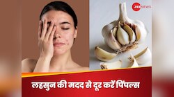 महंगे स्किन केयर में न फूंके अपने पैसे, लहसुन की एक कली से मिलेगा पिंपल फ्री फेस