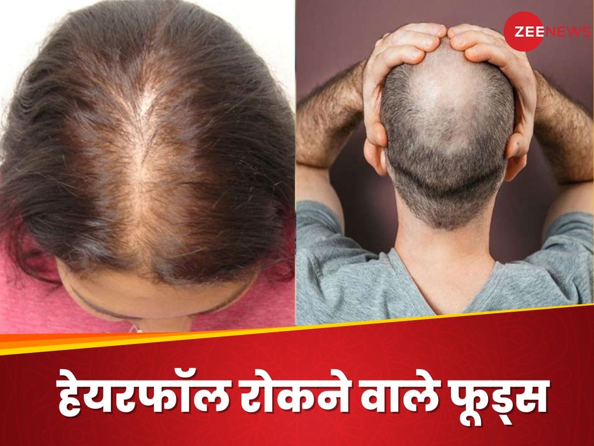 Hair Fall: बालों को टूटने से बचाएंगे ये 5 खास फूड्स, मिलेंगी लंबी और घनी जुल्फें