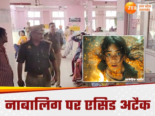 Kushinagar News: नाबालिग लड़की पर घर में घुसकर एसिड अटैक, कुशीनगर मेडिकल कॉलेज में भर्ती