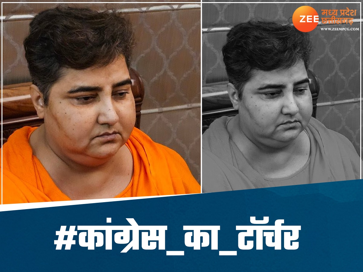 Sadhvi Pragya X post with swelled face 