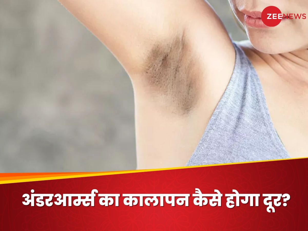 Dark Underarms: शर्मिंदगी की वजह बन गए डार्क अंडरआर्म्स, इस तरह दूर होगा बगल का कालापन