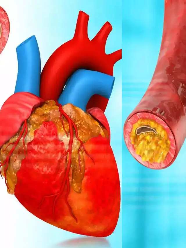 हार्ट तक जाने वाली वाली नसों में नहीं होगा ब्लॉकेज, बस करें ये काम 