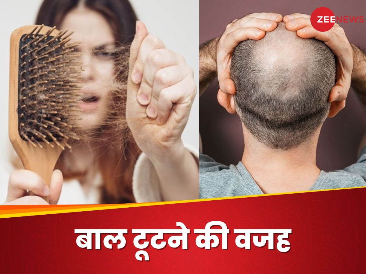 हेयरफॉल आखिर होता क्यों है? जानें गंजेपन से बचना है तो आपको क्या करना होगा