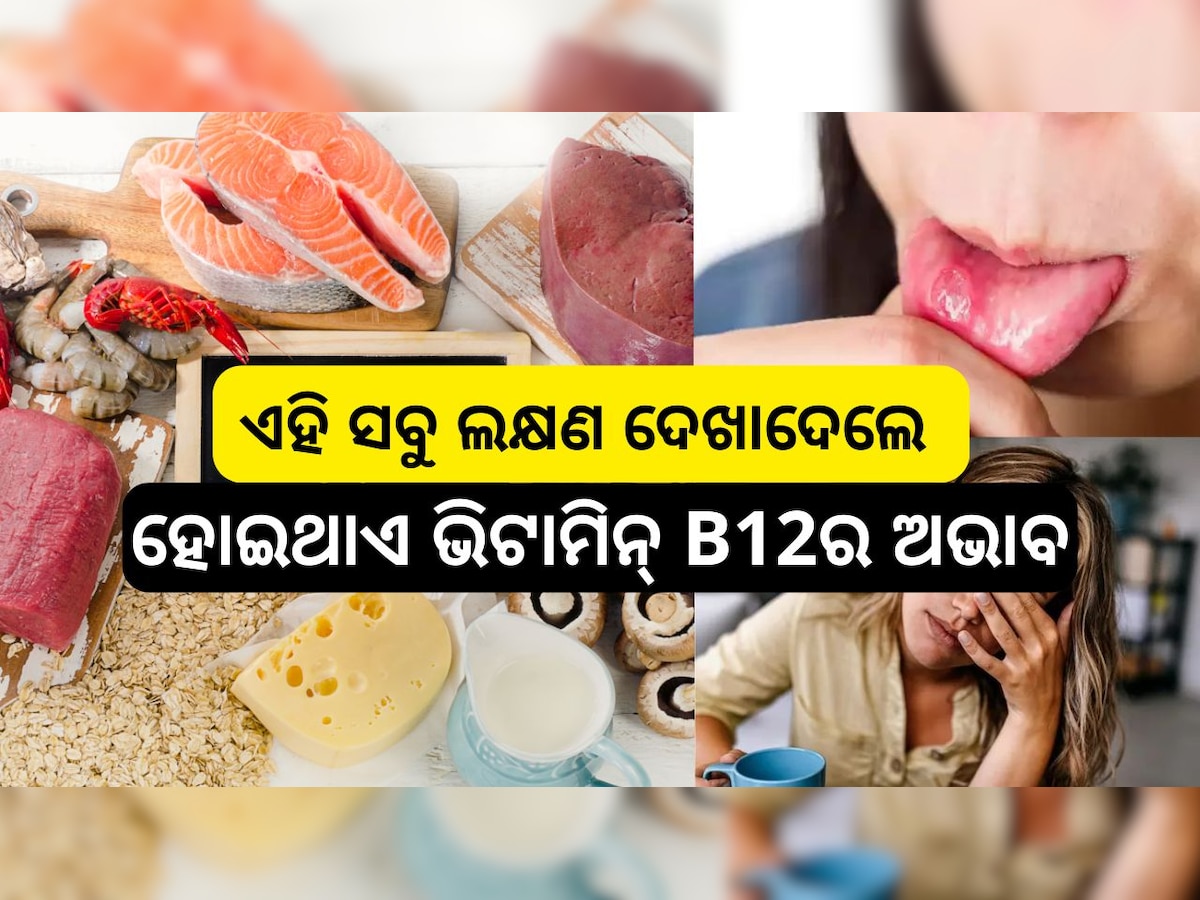 Vitamin B-12 Symptoms: ଶରୀରରେ ଏହି ସବୁ ଲକ୍ଷଣ ଦେଖାଦେଲେ ହୋଇଥାଏ ଭିଟାମିନ୍ B12ର ଅଭାବ