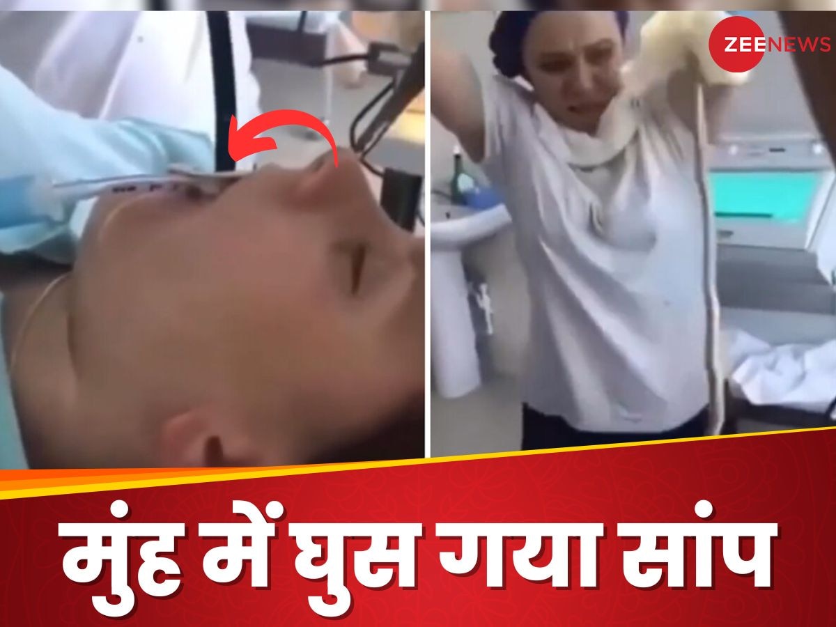 Video: सोते वक्त मुंह के अंदर घुस गया 4 फीट लंबा सांप, डॉक्टर ने निकालने के लिए किया ऐसा काम