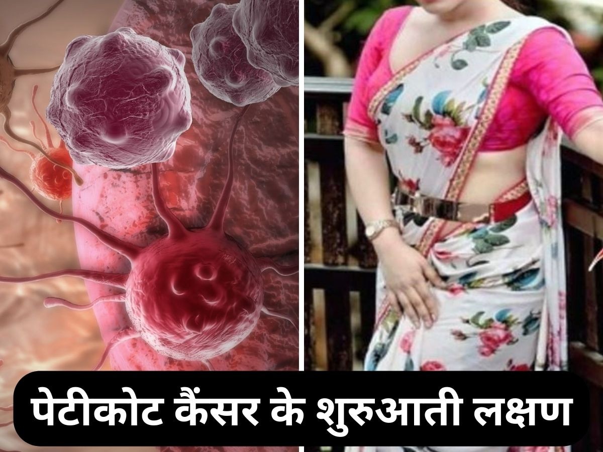 Petticoat Cancer: भारतीय महिलाओं में तेजी से बढ़ रहा पेटीकोट कैंसर! ये 4 शुरुआती लक्षण दिखें तो तुरंत डॉक्टर को दिखाएं