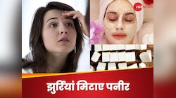 बढ़ती उम्र के असर को कम कर सकता है पनीर, घर पर बनाएं झुर्रियां मिटाने वाला फेस पैक