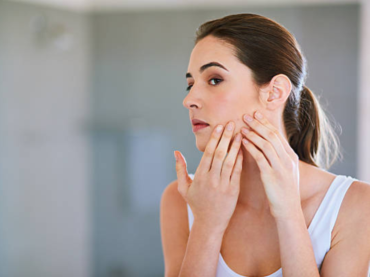 Cracks appearing on the skin due to cold make cracked cheeks soft with ...