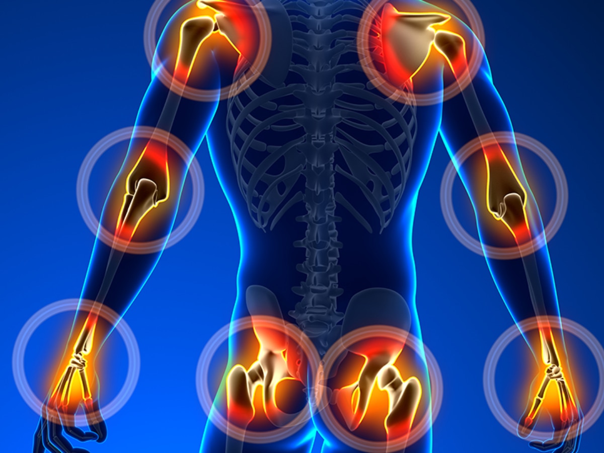 ठंड में बढ़ गया है गठिया का दर्द, तुरंत आराम के लिए करें इन 5 हर्ब्स का सेवन