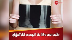 Calcium और Vitamin D ही नहीं, इन सारे न्यूट्रिएंट्स से भी हड्डियां होती हैं मजबूत