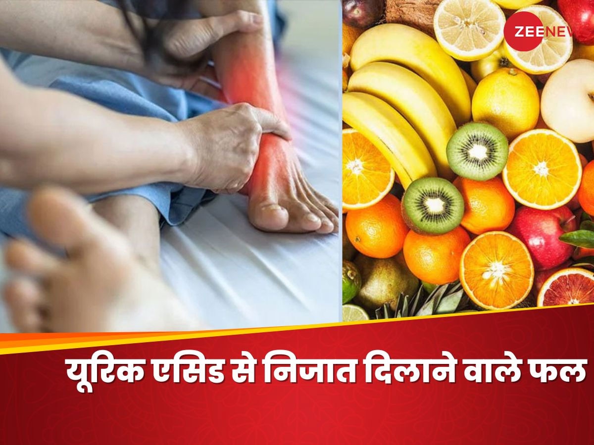 Uric Acid: जोड़ों में जमा यूरिक एसिड दे रहा दर्द? इन फ्रूट्स को खाने से दूर होगी तकलीफ